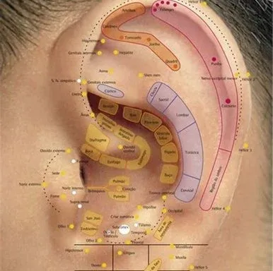 Auriculoterapia